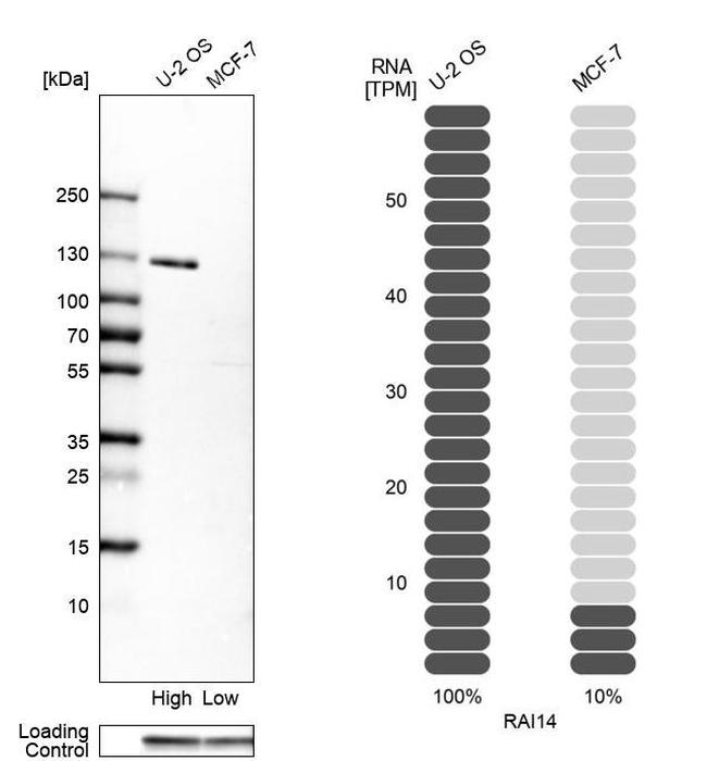 RAI14 Antibody in Western Blot (WB)