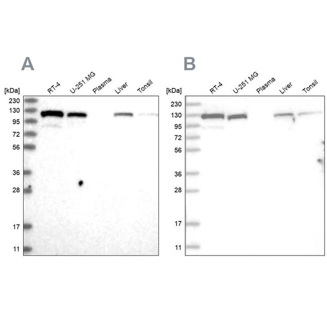 RAI14 Antibody in Western Blot (WB)