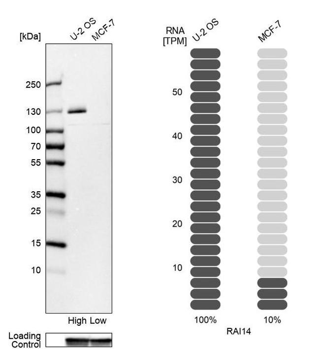 RAI14 Antibody in Western Blot (WB)