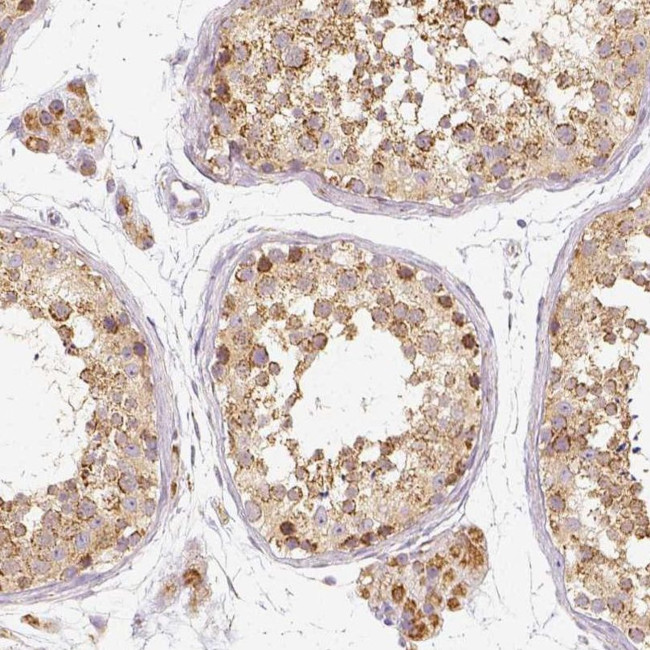 PGAM5 Antibody in Immunohistochemistry (IHC)