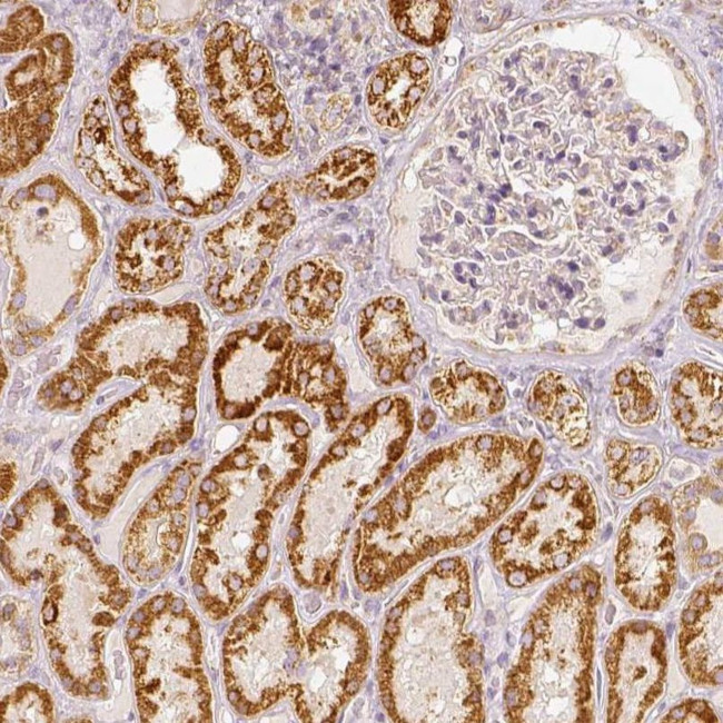 PGAM5 Antibody in Immunohistochemistry (IHC)