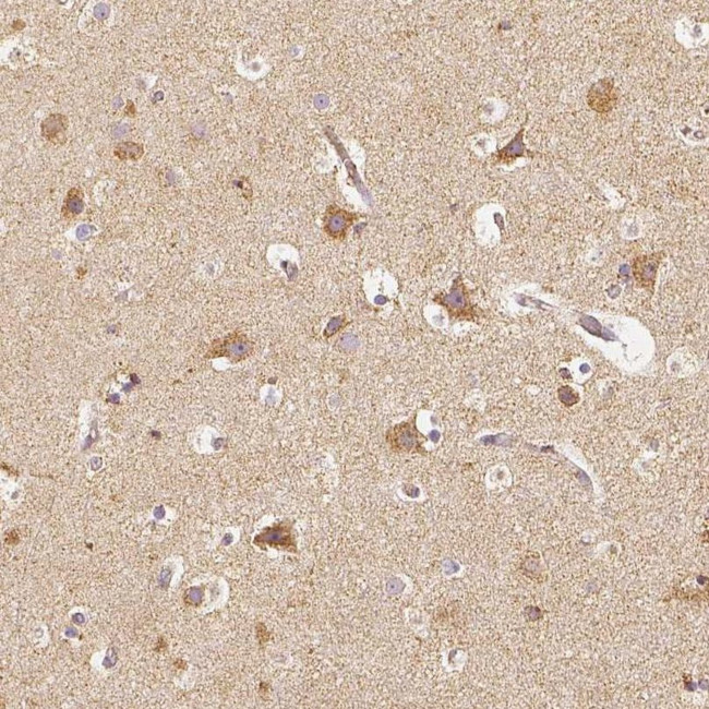 PGAM5 Antibody in Immunohistochemistry (IHC)