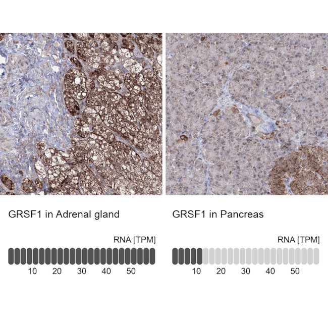 GRSF1 Antibody in Immunohistochemistry (IHC)