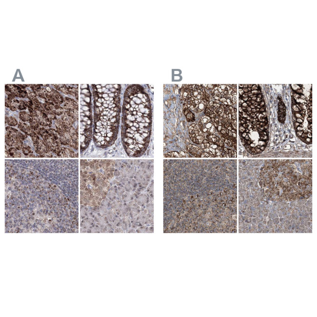 GRSF1 Antibody in Immunohistochemistry (IHC)