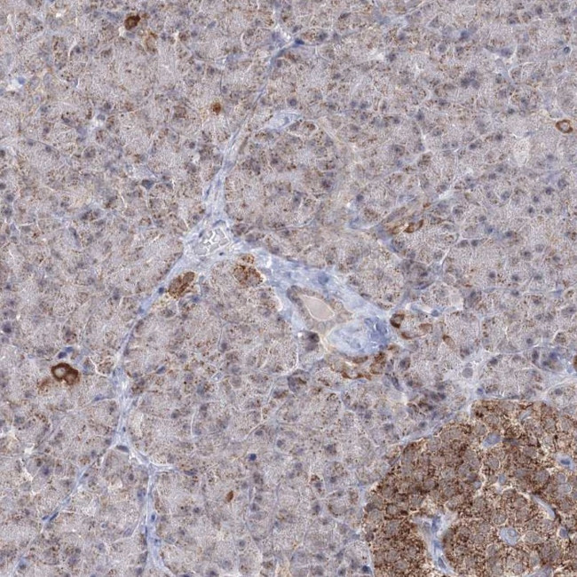 GRSF1 Antibody in Immunohistochemistry (IHC)