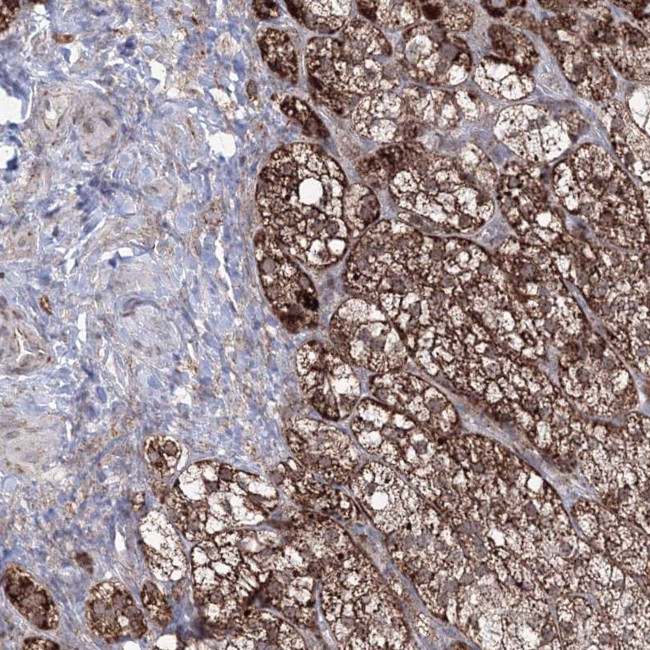 GRSF1 Antibody in Immunohistochemistry (IHC)