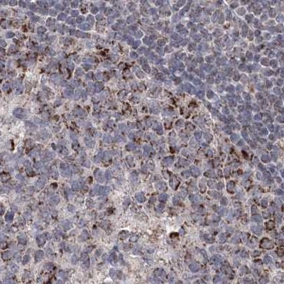 GRSF1 Antibody in Immunohistochemistry (IHC)