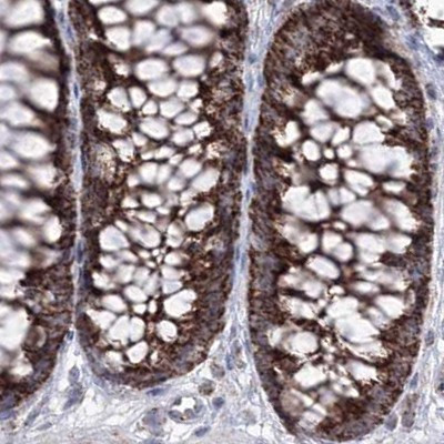 GRSF1 Antibody in Immunohistochemistry (IHC)