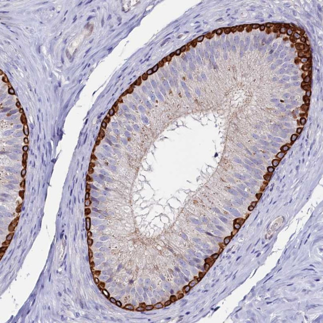 ASTE1 Antibody in Immunohistochemistry (IHC)