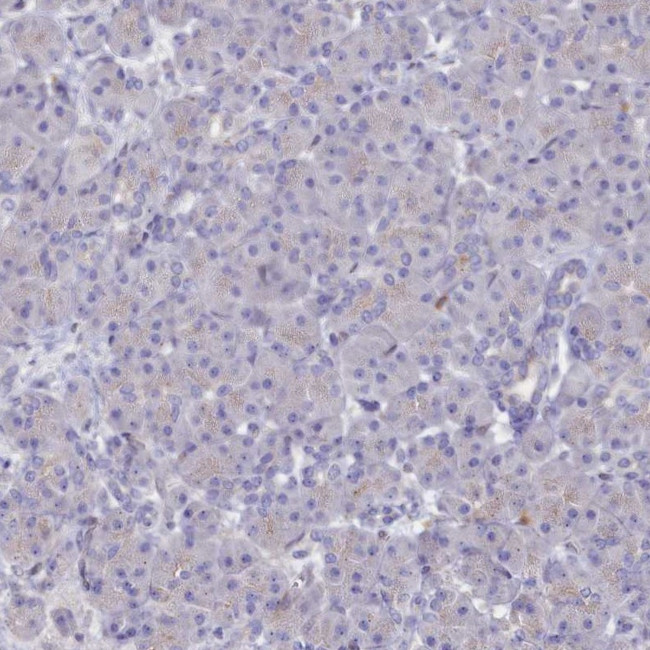 ASTE1 Antibody in Immunohistochemistry (IHC)