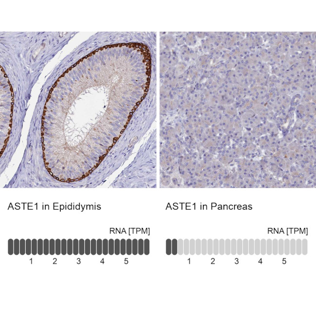 ASTE1 Antibody