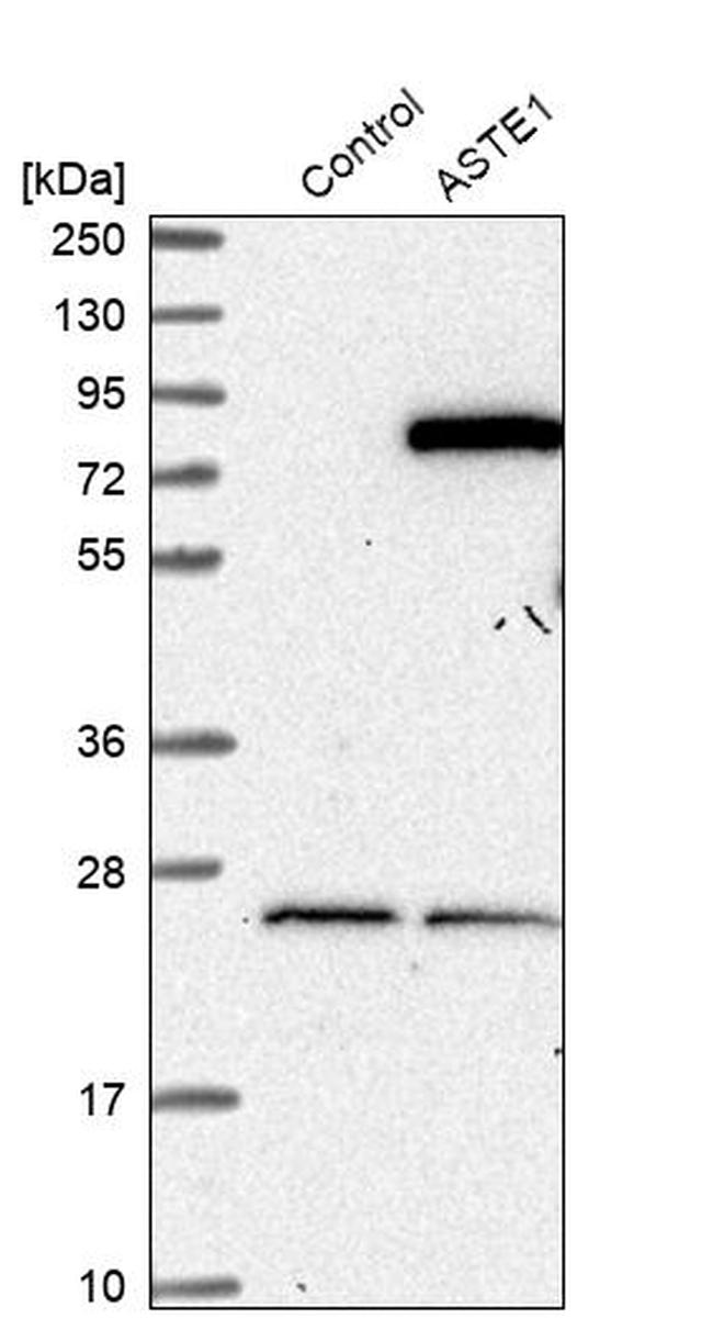 ASTE1 Antibody in Western Blot (WB)