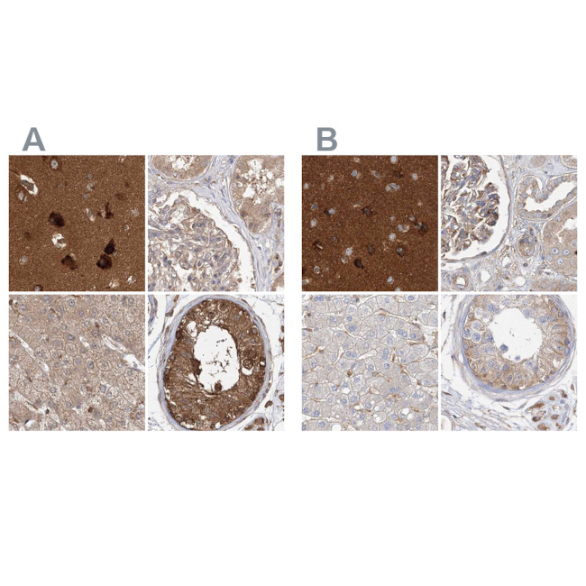 WDR37 Antibody in Immunohistochemistry (IHC)