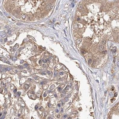 WDR37 Antibody in Immunohistochemistry (IHC)