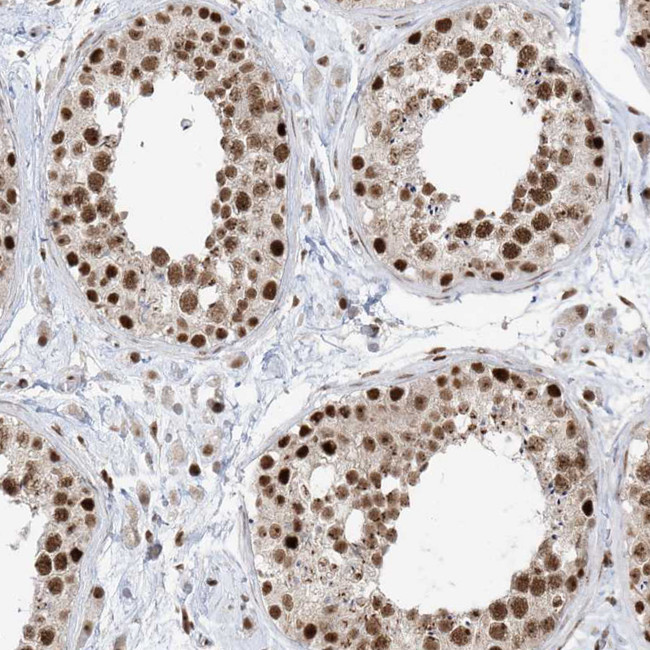 SKIV2L2 Antibody in Immunohistochemistry (IHC)