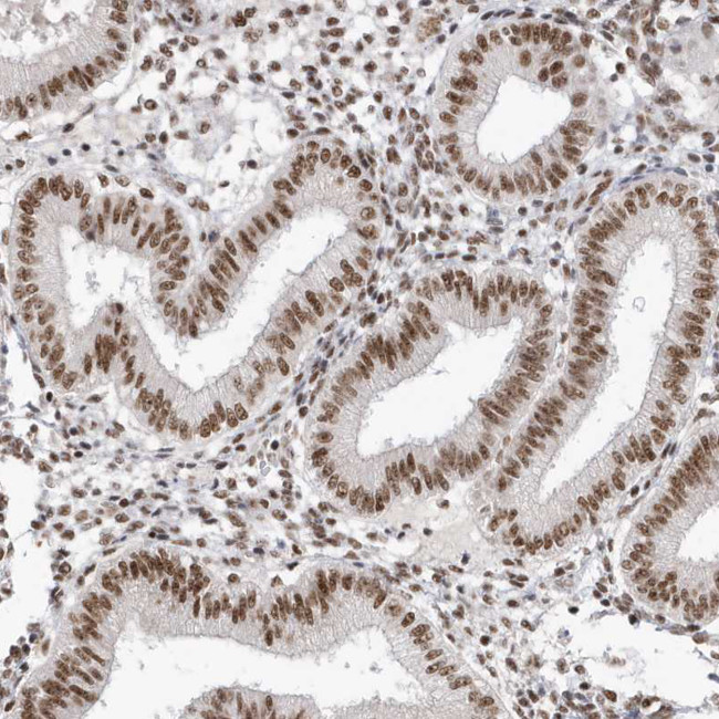 SKIV2L2 Antibody in Immunohistochemistry (IHC)