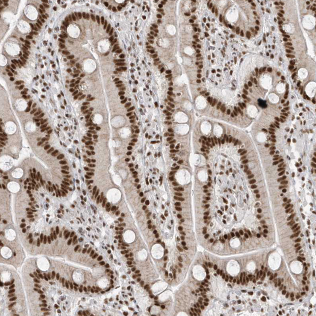 SKIV2L2 Antibody in Immunohistochemistry (IHC)