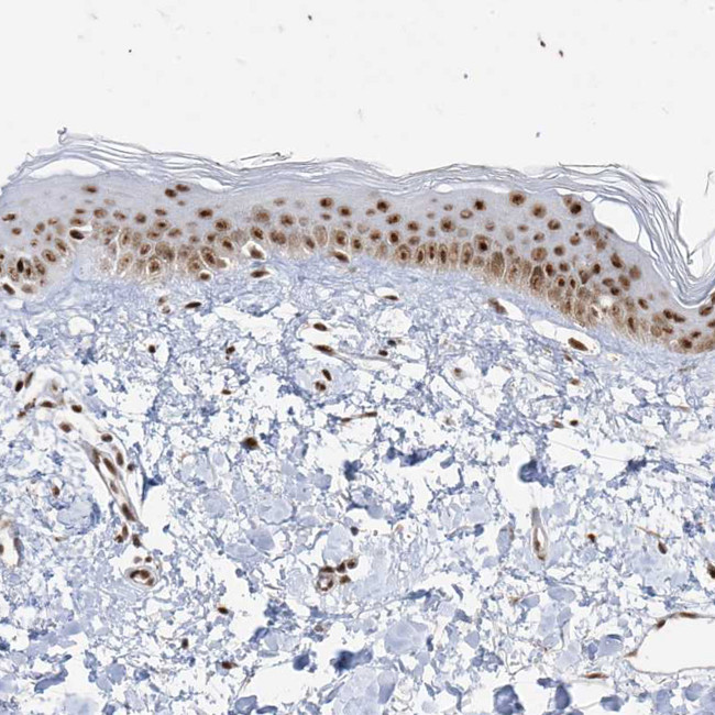 SKIV2L2 Antibody in Immunohistochemistry (IHC)