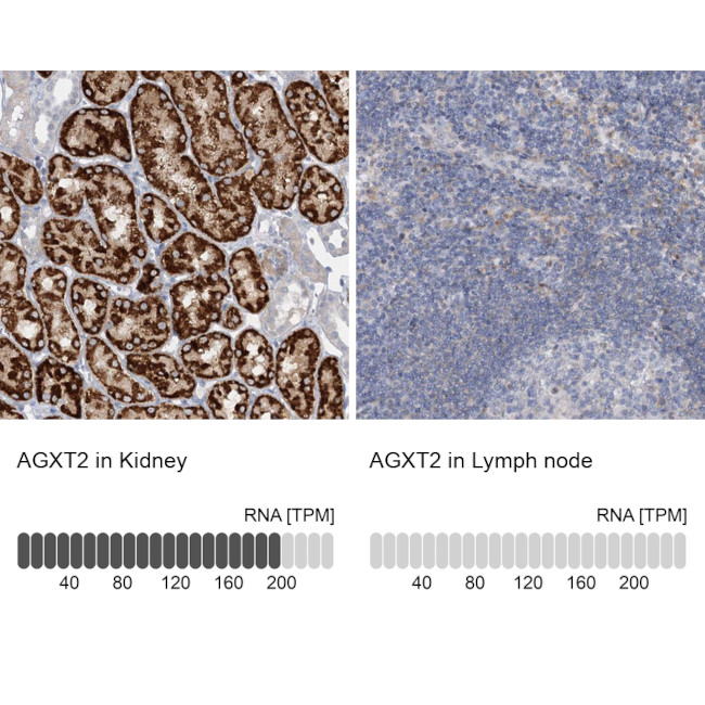AGXT2 Antibody in Immunohistochemistry (IHC)