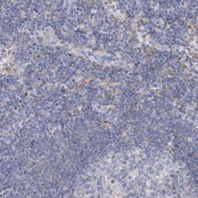 AGXT2 Antibody in Immunohistochemistry (IHC)