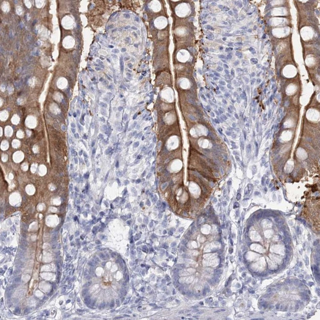 SLC6A19 Antibody in Immunohistochemistry (IHC)