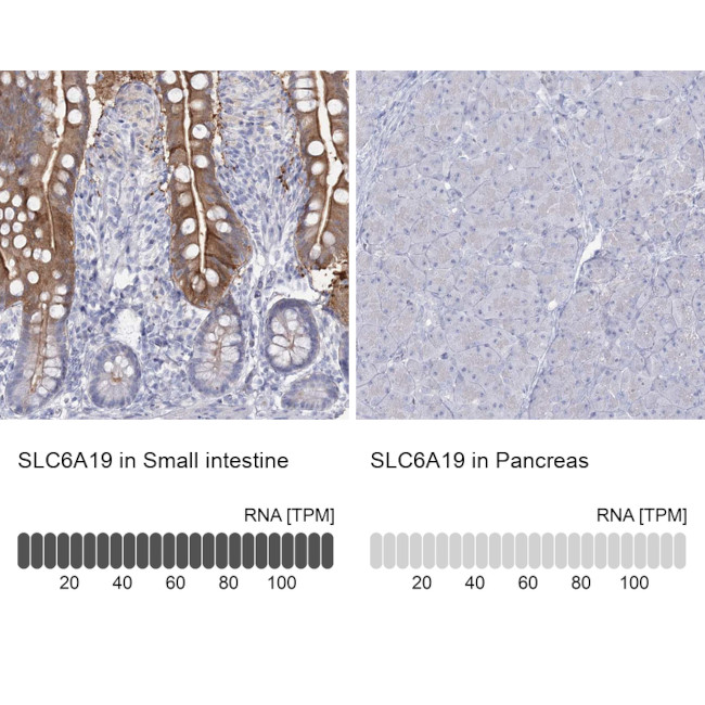 SLC6A19 Antibody