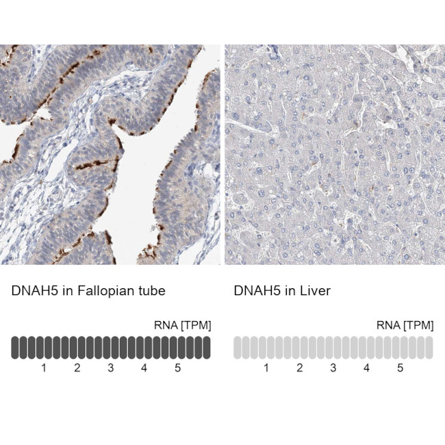 DNAH5 Antibody in Immunohistochemistry (IHC)