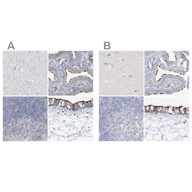 DNAH5 Antibody in Immunohistochemistry (IHC)