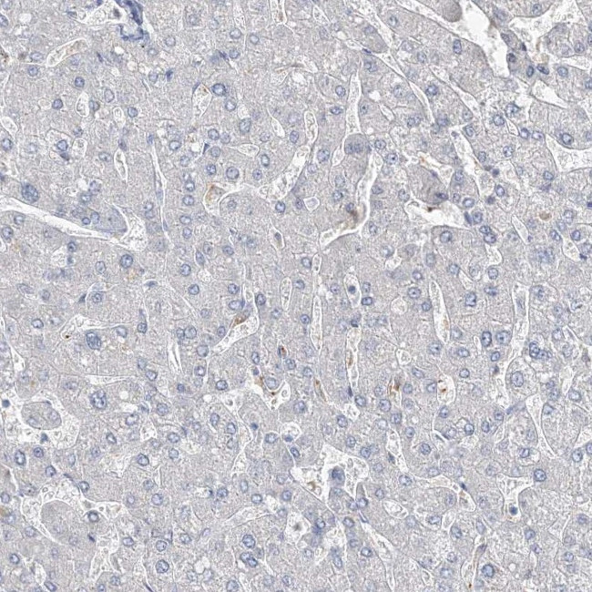 DNAH5 Antibody in Immunohistochemistry (IHC)