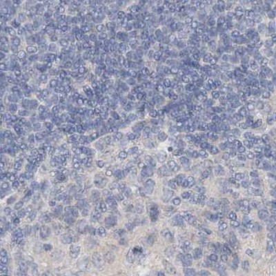 DNAH5 Antibody in Immunohistochemistry (IHC)