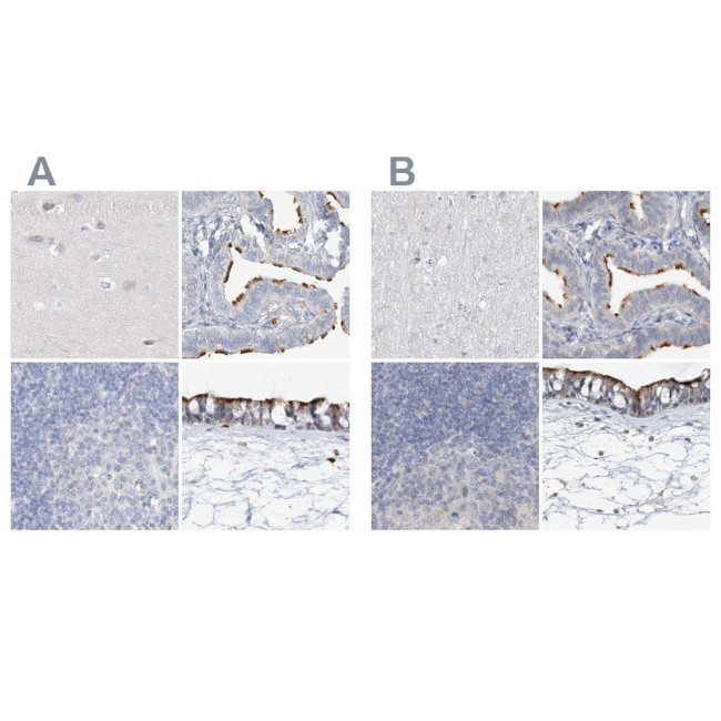 DNAH5 Antibody in Immunohistochemistry (IHC)