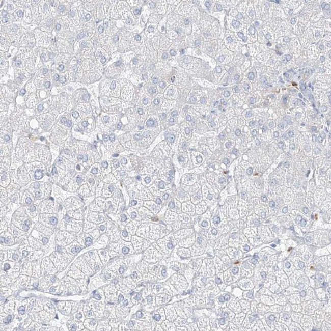 DNAH5 Antibody in Immunohistochemistry (IHC)