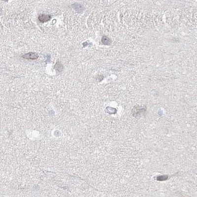 DNAH5 Antibody in Immunohistochemistry (IHC)