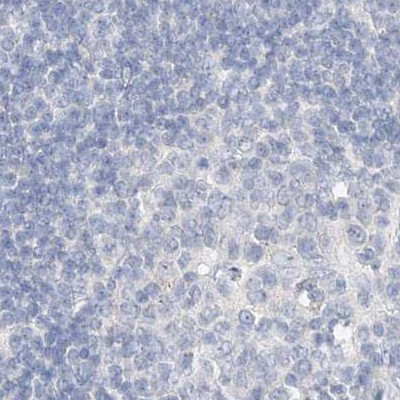 DNAH5 Antibody in Immunohistochemistry (IHC)