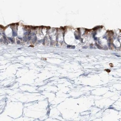 DNAH5 Antibody in Immunohistochemistry (IHC)