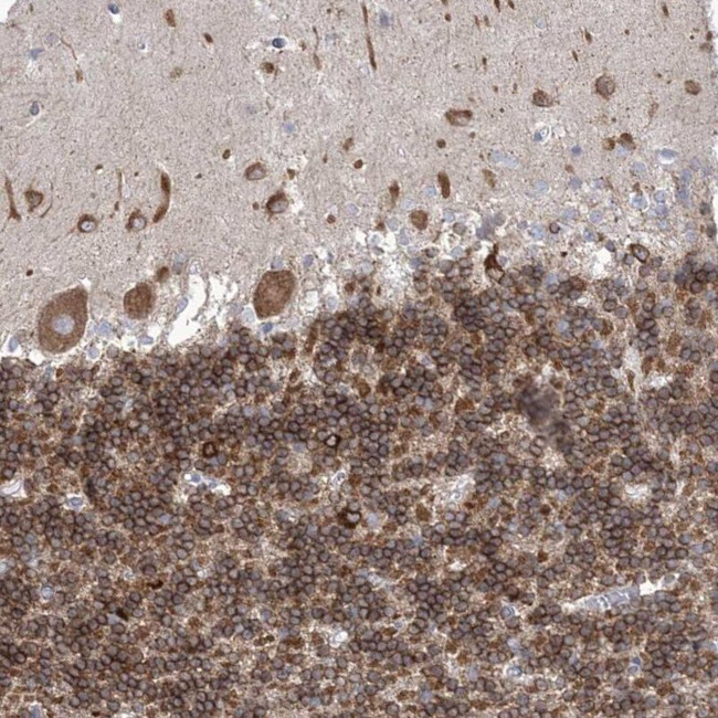 WDR27 Antibody in Immunohistochemistry (IHC)