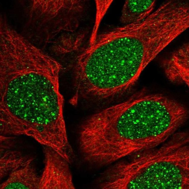 RAP80 Antibody in Immunocytochemistry (ICC/IF)