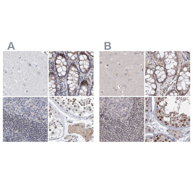 RAP80 Antibody in Immunohistochemistry (IHC)