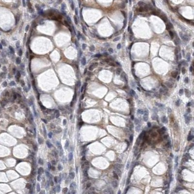 RAP80 Antibody in Immunohistochemistry (IHC)