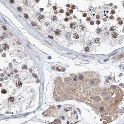 RAP80 Antibody in Immunohistochemistry (IHC)