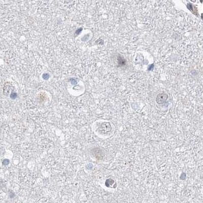 RAP80 Antibody in Immunohistochemistry (IHC)