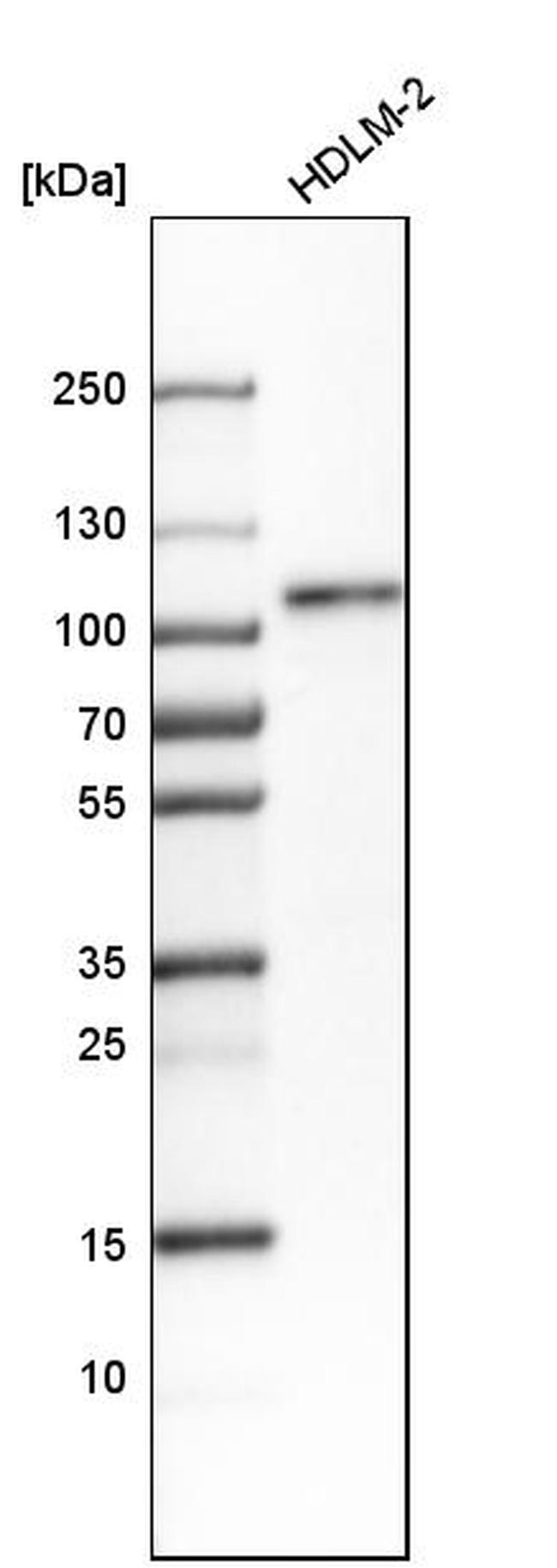 RAP80 Antibody in Western Blot (WB)