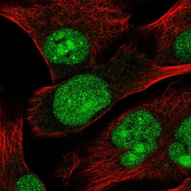 TSSK3 Antibody in Immunocytochemistry (ICC/IF)