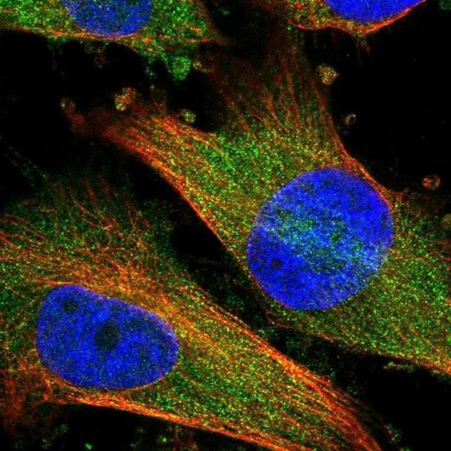 DDO Antibody in Immunocytochemistry (ICC/IF)