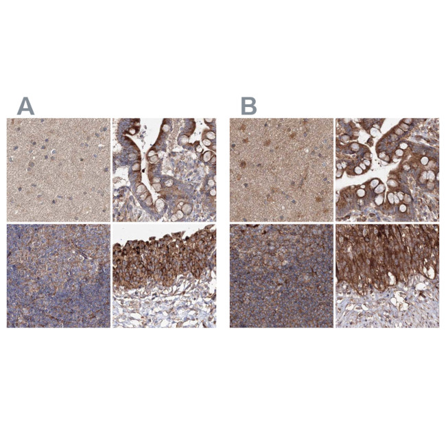 DDO Antibody in Immunohistochemistry (IHC)