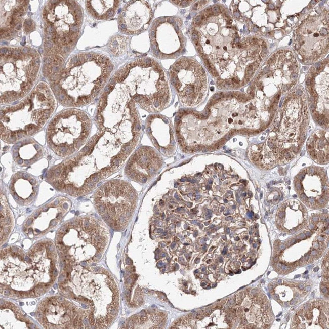 DDO Antibody in Immunohistochemistry (IHC)