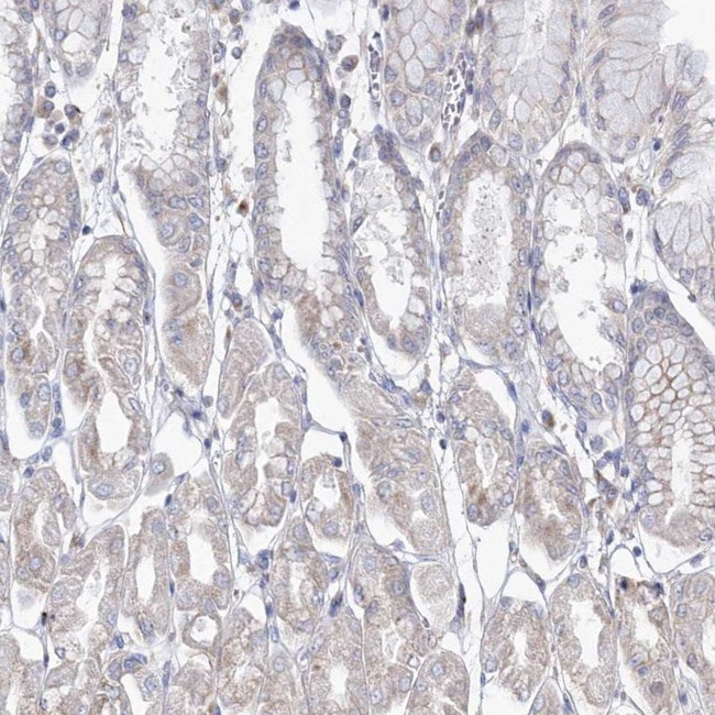 DDO Antibody in Immunohistochemistry (IHC)