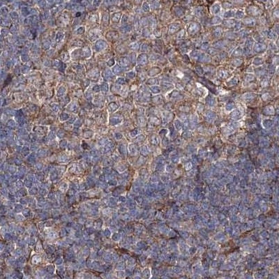 DDO Antibody in Immunohistochemistry (IHC)