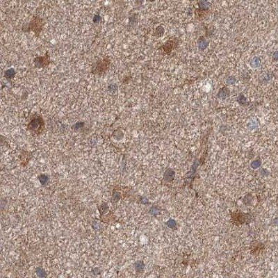 DDO Antibody in Immunohistochemistry (IHC)