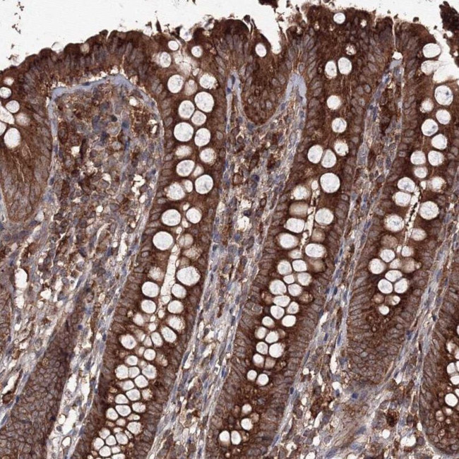 DDO Antibody in Immunohistochemistry (IHC)